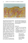 visit page 44
